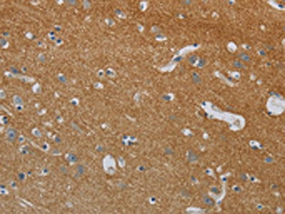 DPYSL3 Antibody