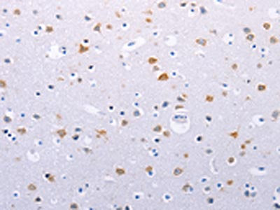 HMGB3 Antibody