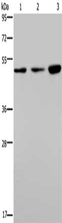 PHKG1 Antibody