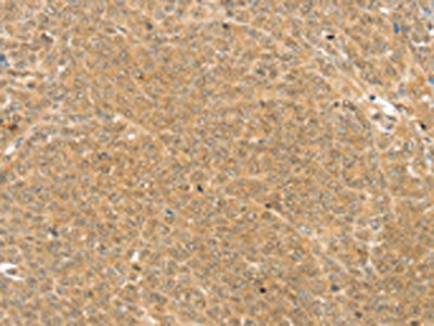 TRIM22 Antibody