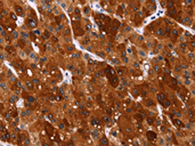 HSPB6 Antibody