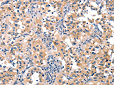 EIF4G1 Antibody