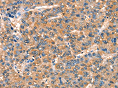ARHGAP4 Antibody