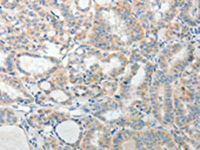 AGAP1 Antibody