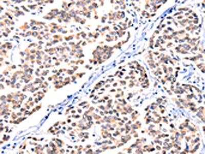 FBLN1 Antibody