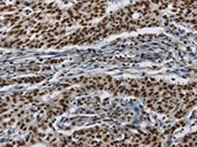 HIST1H2AB Antibody