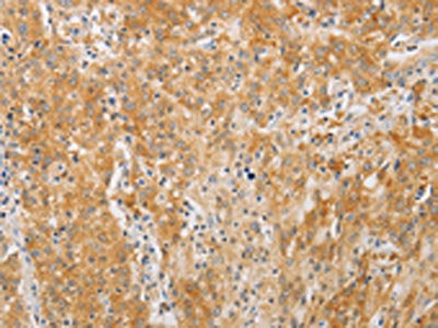PDE4D Antibody