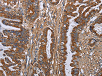 LUM Antibody