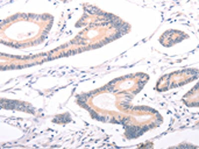 ABCF3 Antibody