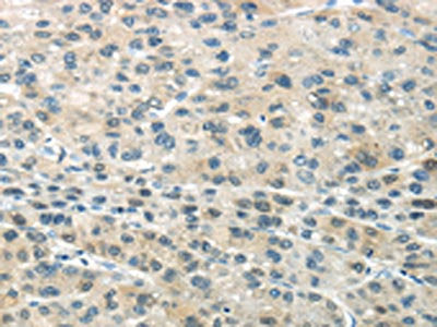 SMYD2 Antibody