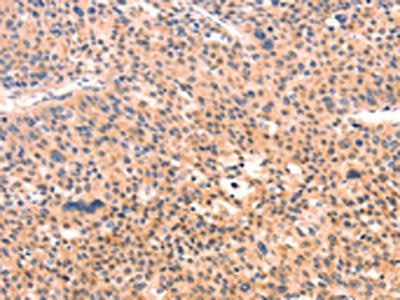 APBA2 Antibody