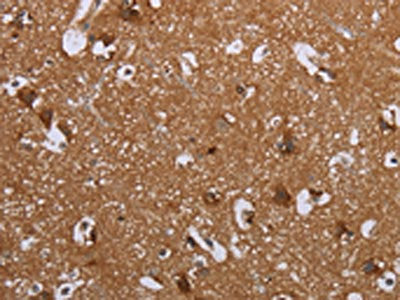 LIMK1 Antibody