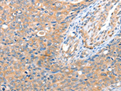 ACOT8 Antibody