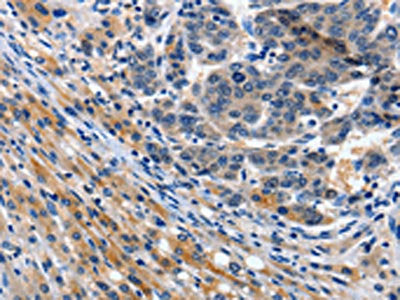 ITGAX Antibody