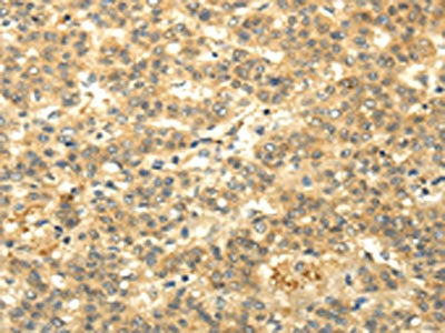 CAMK1G Antibody