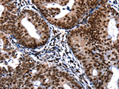DFFA Antibody