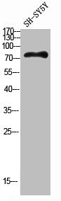 HGF Antibody