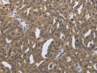 PRKAR1B Antibody