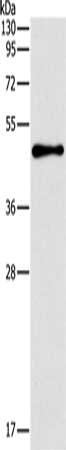 TFAP2B Antibody
