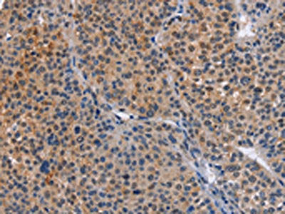 MAP3K13 Antibody