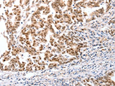 CTBP2 Antibody
