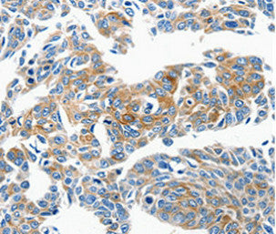 CCL23 Antibody