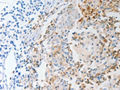 NFKB2 Antibody