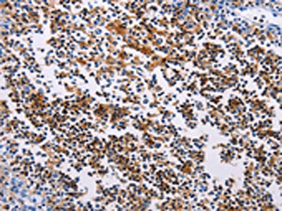 HDAC4 Antibody