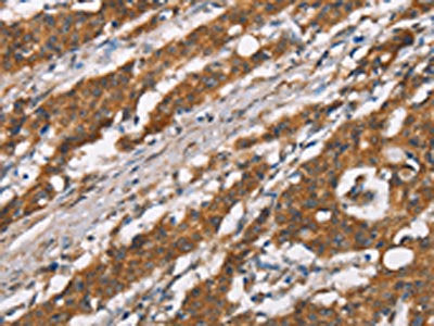 DSC2 Antibody