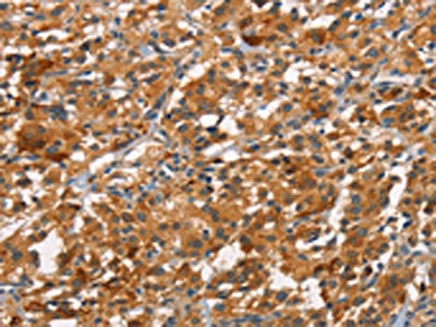 CDC25B Antibody
