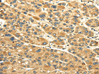 UACA Antibody