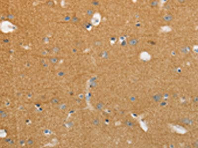 NFASC Antibody