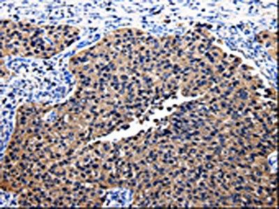 BID Antibody