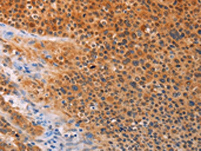 ADHFE1 Antibody