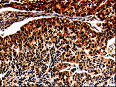 ALOX5 Antibody
