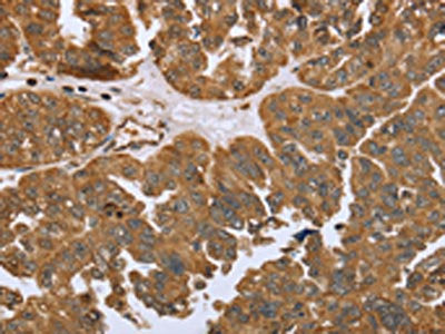 IKBKE Antibody