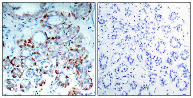 Phospho-BCL2L11 (Ser69) Antibody