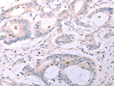ACOT2 Antibody