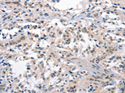 CRHR1 Antibody
