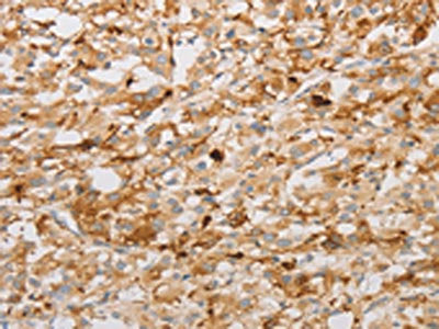 S100A1 Antibody