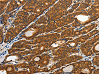 CRP Antibody