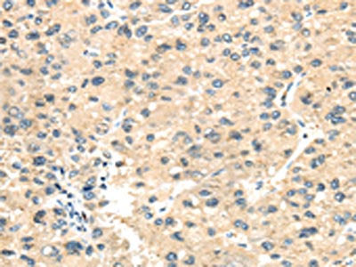 THBS1 Antibody