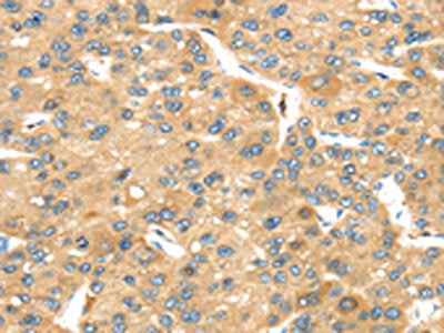 UBTD2 Antibody