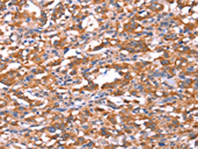 FAM13B Antibody