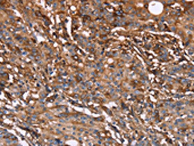 HP Antibody