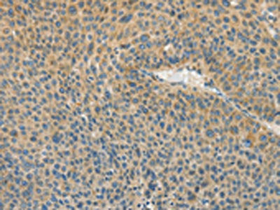 ASPA Antibody