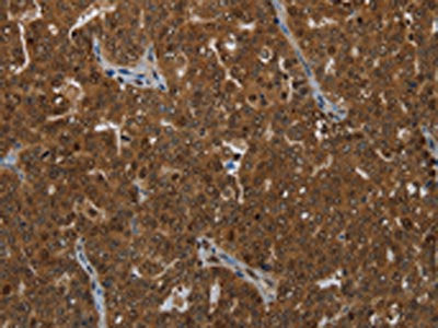 KLRF1 Antibody