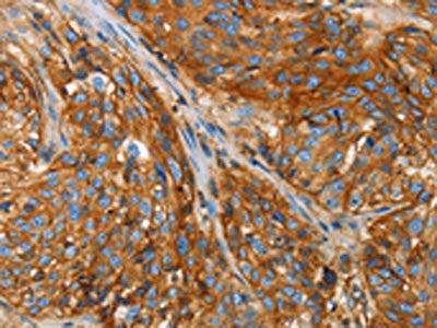 B2M Antibody