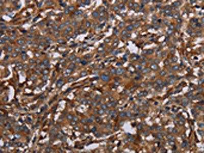 MAP3K11 Antibody