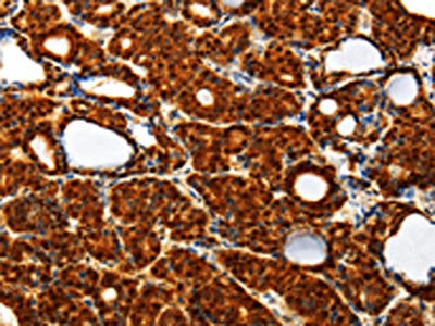TXN Antibody